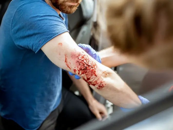 DUI Victim Injury Lawyer